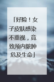 好险！女子皮肤感染不重视，竟致颅内脓肿危及生命